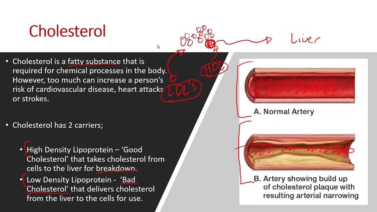 AQA A Level PE (2018) - Cardiovascular System Lesson
