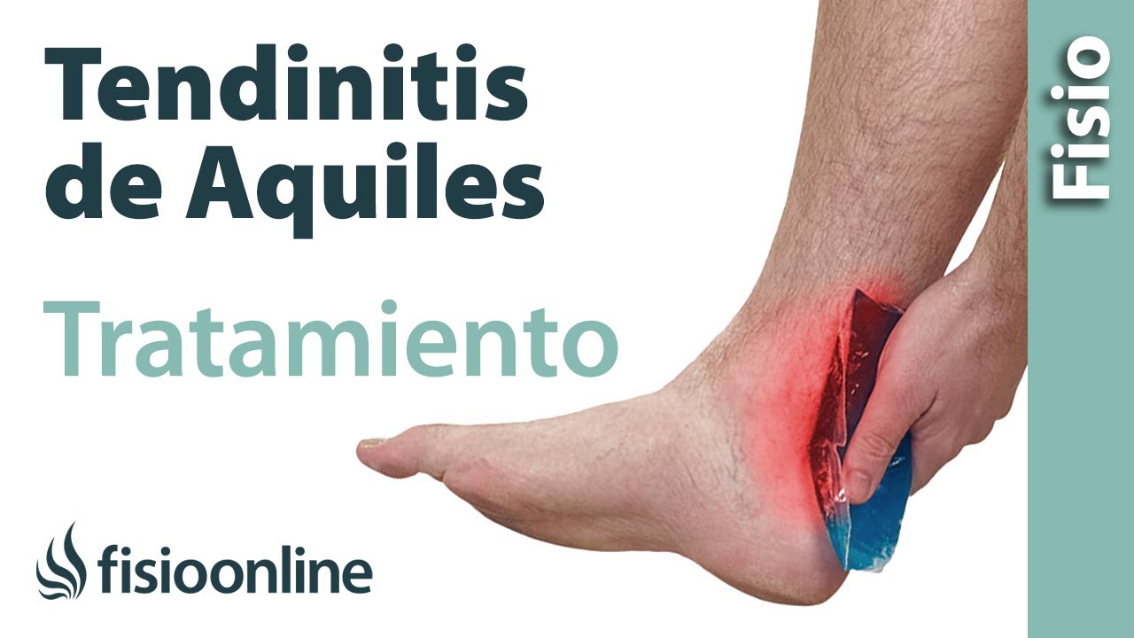 ¿Cómo tratar la Tendinitis de Aquiles? Ejercicios y consejos de un fisioterapeuta