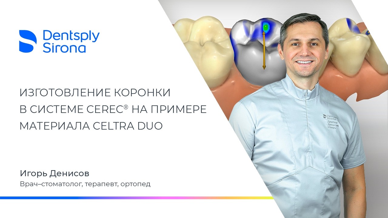 Изготовление коронки в системе CEREC на примере материала Celtra Duo