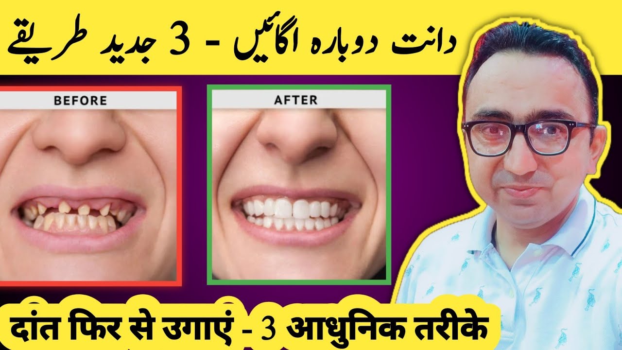 Now YOU Can REGROW Your Teeth! 3 Ways To Regrow Your Teeth
