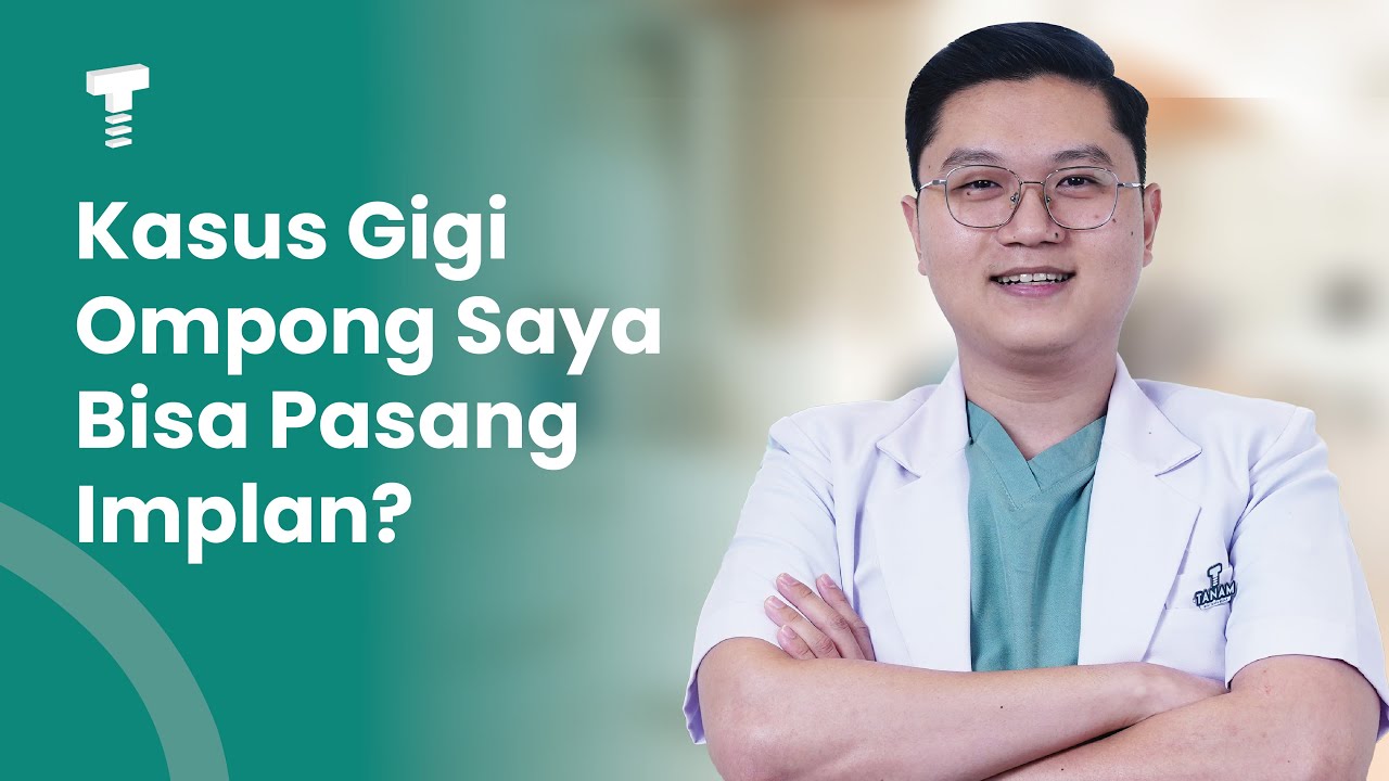 Jangan Asal Implan Gigi, Ini Syaratnya!