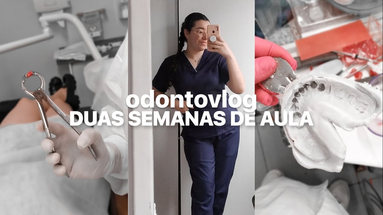 odontovlog: primeira cirurgia que eu vi + endo + prótese | Odonto Energy