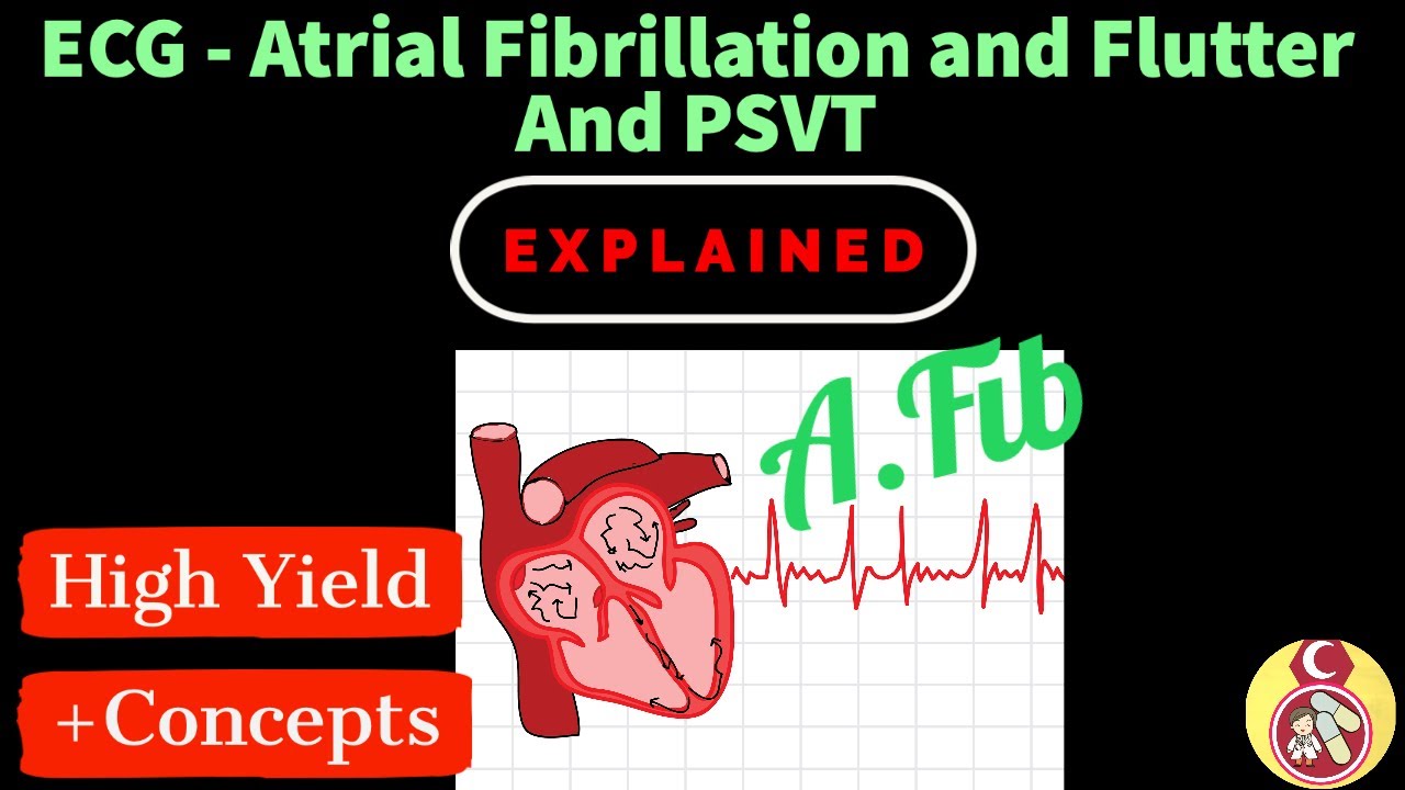 ECG Crash course - #8 Atrial Fibrillation and Atrial Flutter and PSVT