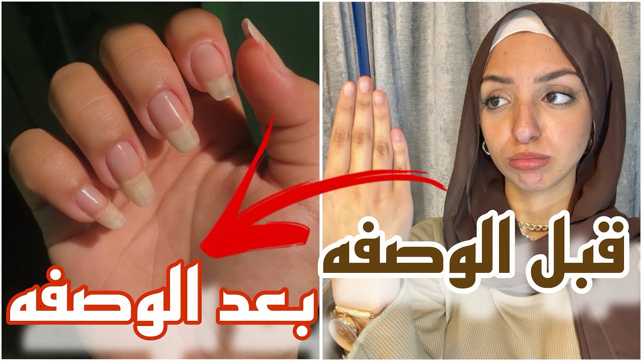 اسرع وصفه لتطويل وتقويه الاظافر في يوم واحد فقط قبل العيد| وصفه فعاله ومجربه100%💅🏻 دلعي نفسك