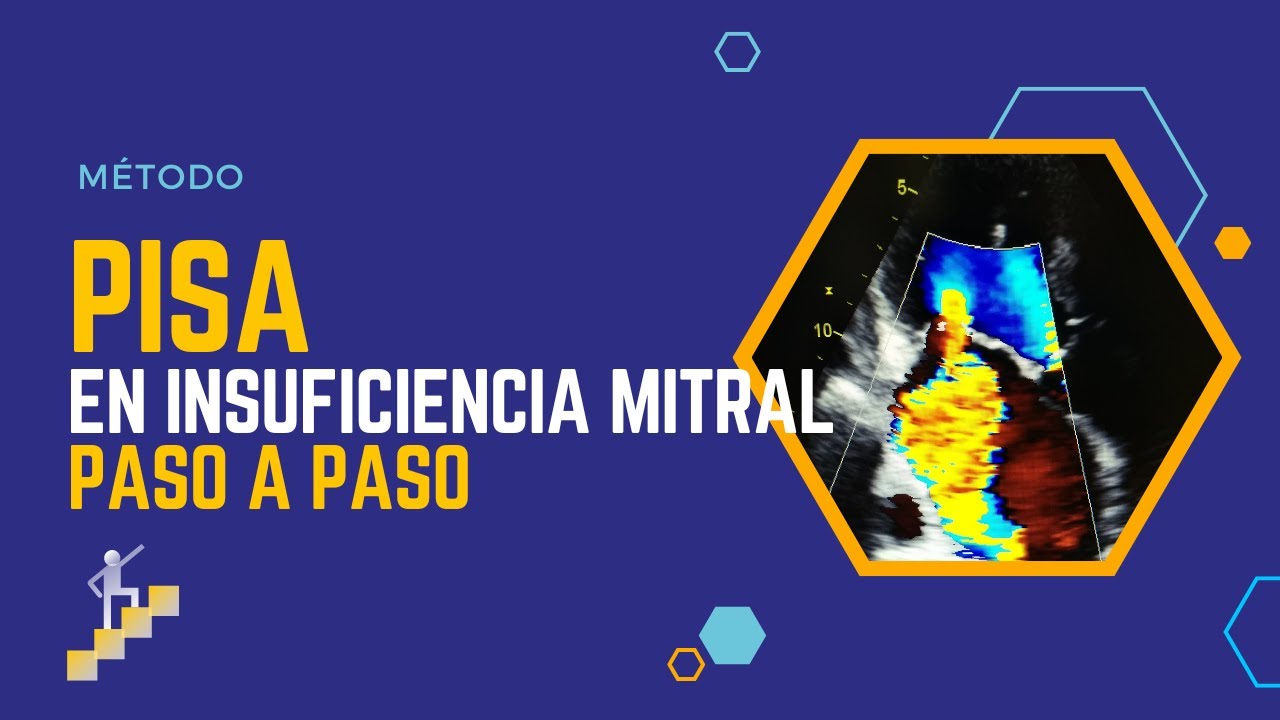 🆓TE LO EXPLICO: PISA en INSUFICIENCIA MITRAL [PASO A PASO]⚠️
