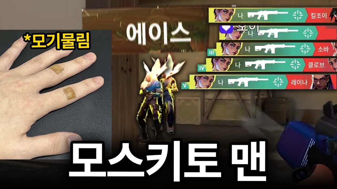 손에 모기한테 3방을 물렸는데.. 갑자기 왜 이런 핵샷을 쏘는 거지????