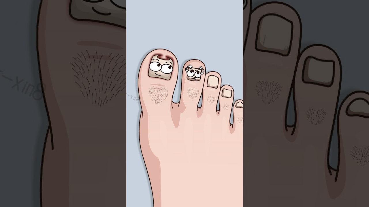 Как избежать инфекции стопы после неудачной стрижки (да, это связано). #шорты