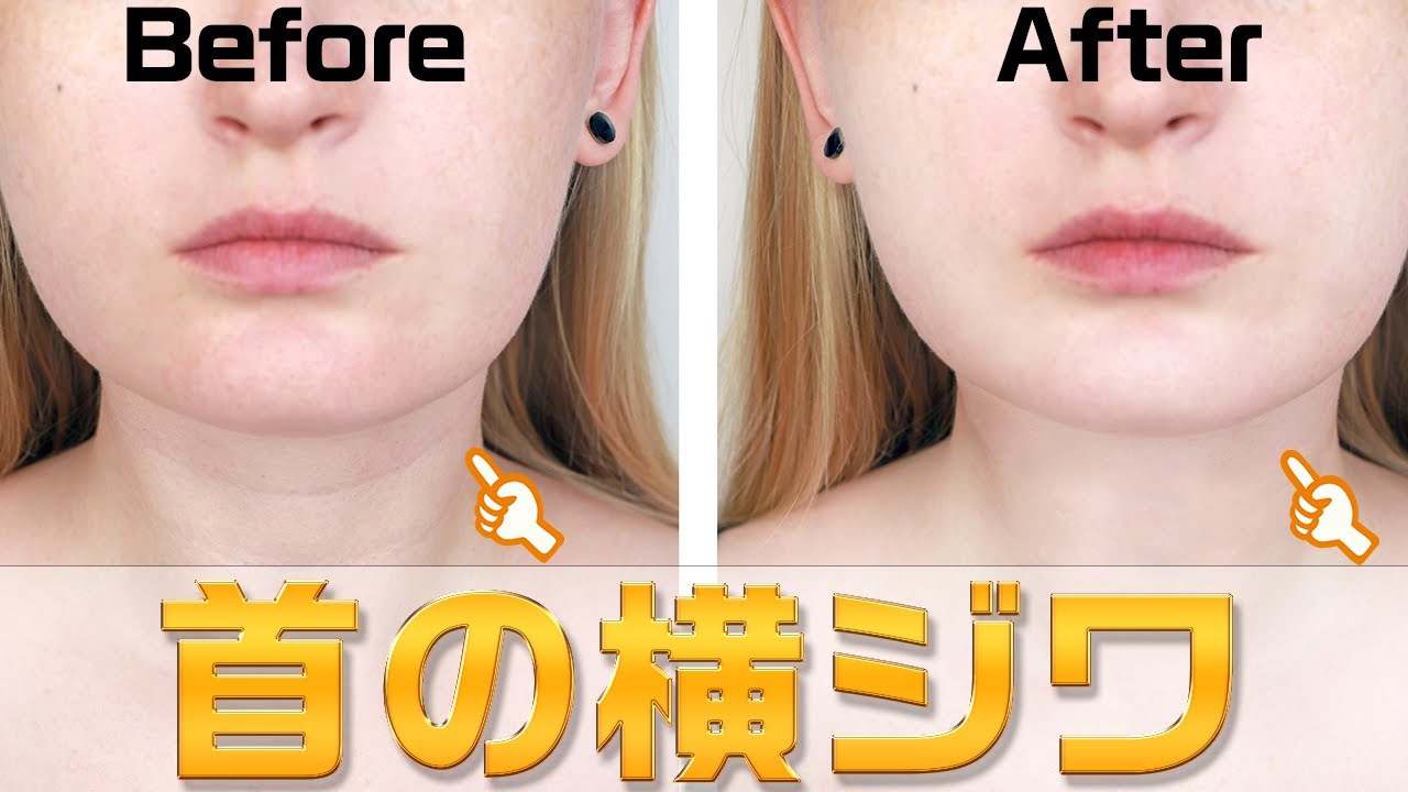 「首の横ジワが薄くならない方、必見」首の横に深く入った横ジワを薄くする「Newネック筋膜リリース＆エクササイズ」remove neck wrinkles【大分県大分市 綜合整体 GENRYU 】