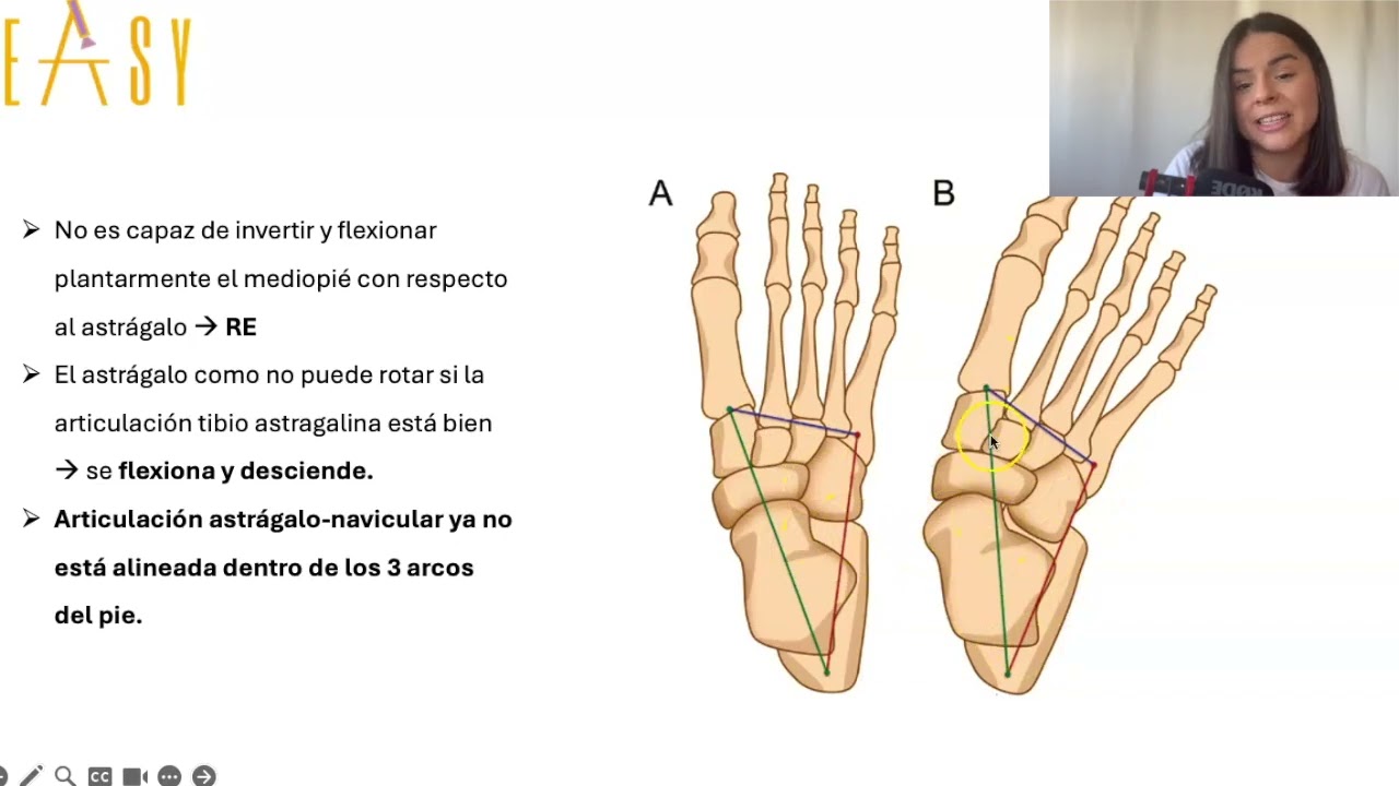 TRATAMIENTO ACTIVO EN TENDINOPATÍA DEL TIBIAL POSTERIOR