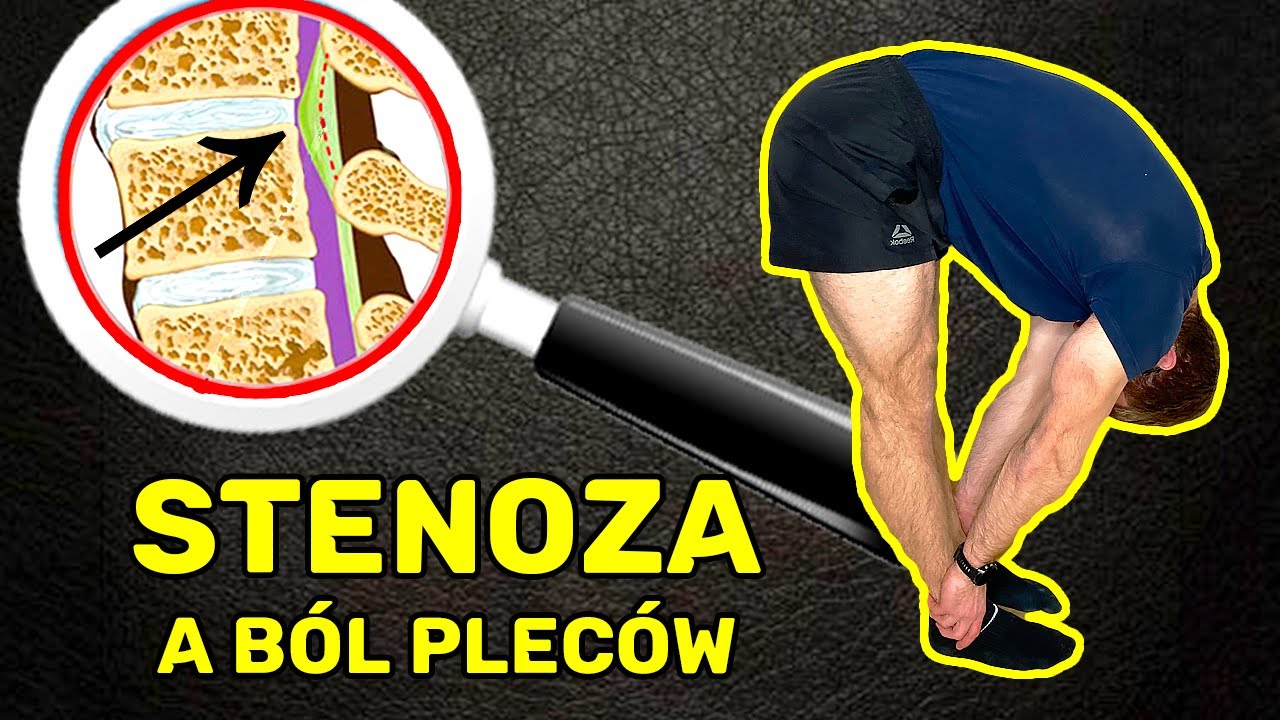 Stenoza odcinka lędźwiowego a przepuklina i kręgozmyk *ból pleców*