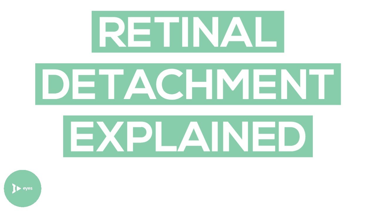 Retinal Detachment Explained | What Are the Signs and Symptoms of a Detached Retina?