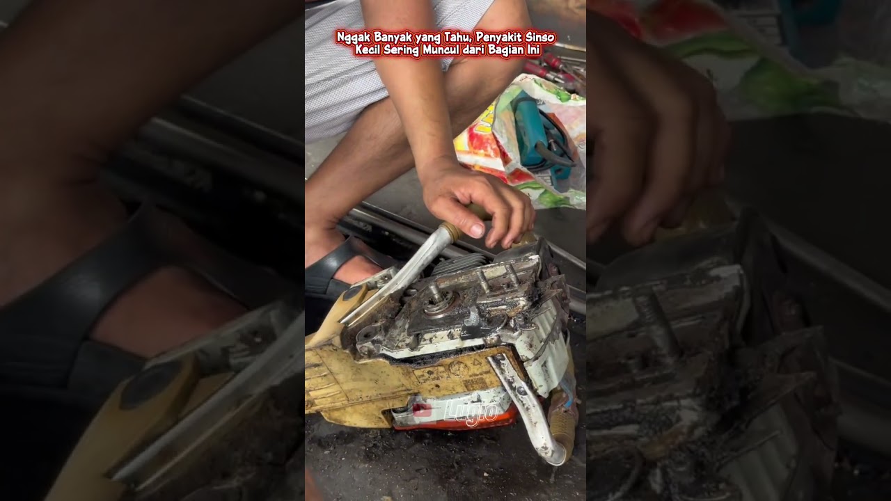 Nggak Banyak yang Tahu, Penyakit Sinso Kecil Sering Muncul dari Bagian Ini