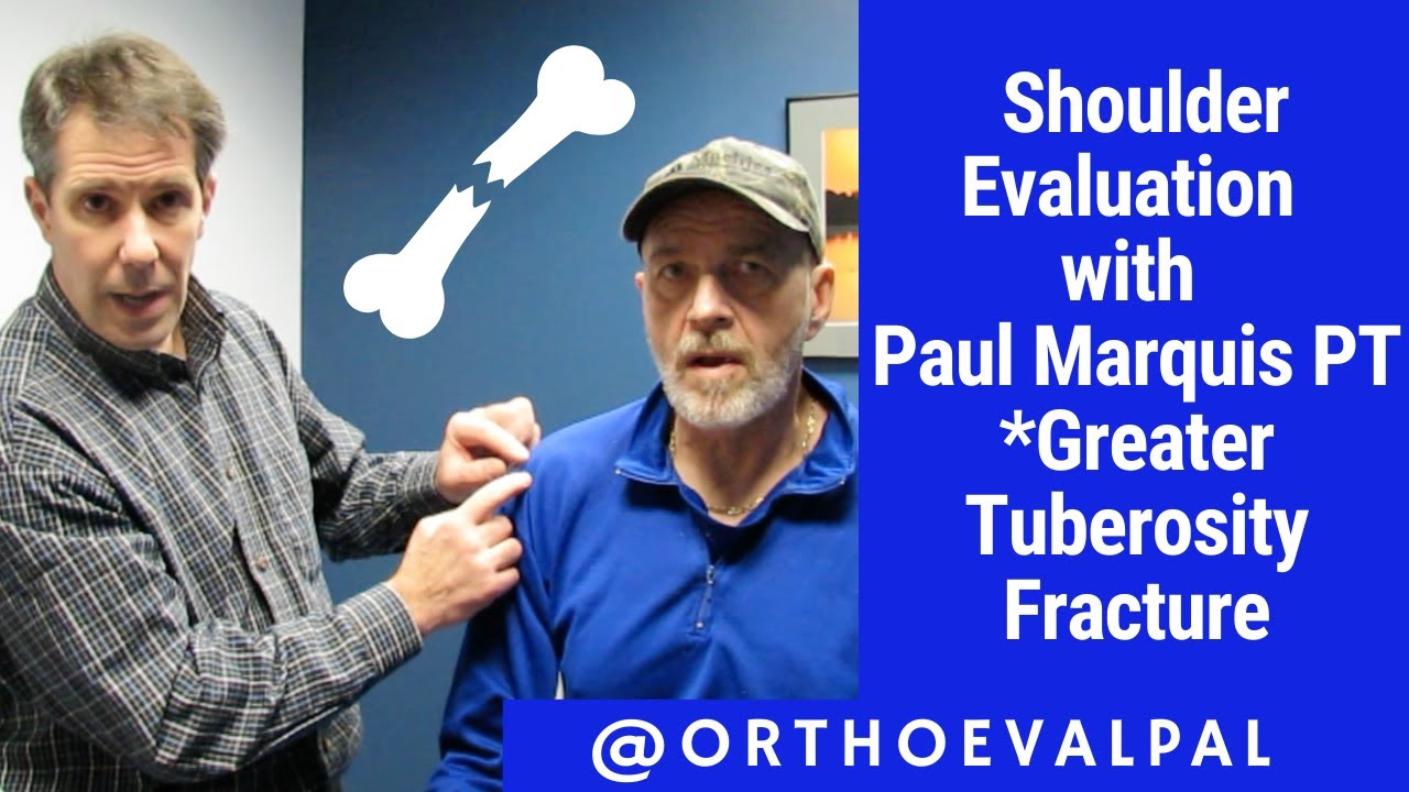 Shoulder Evaluation with @Ortho EVAL Pal With Paul Marquis :Greater Tuberosity Fracture