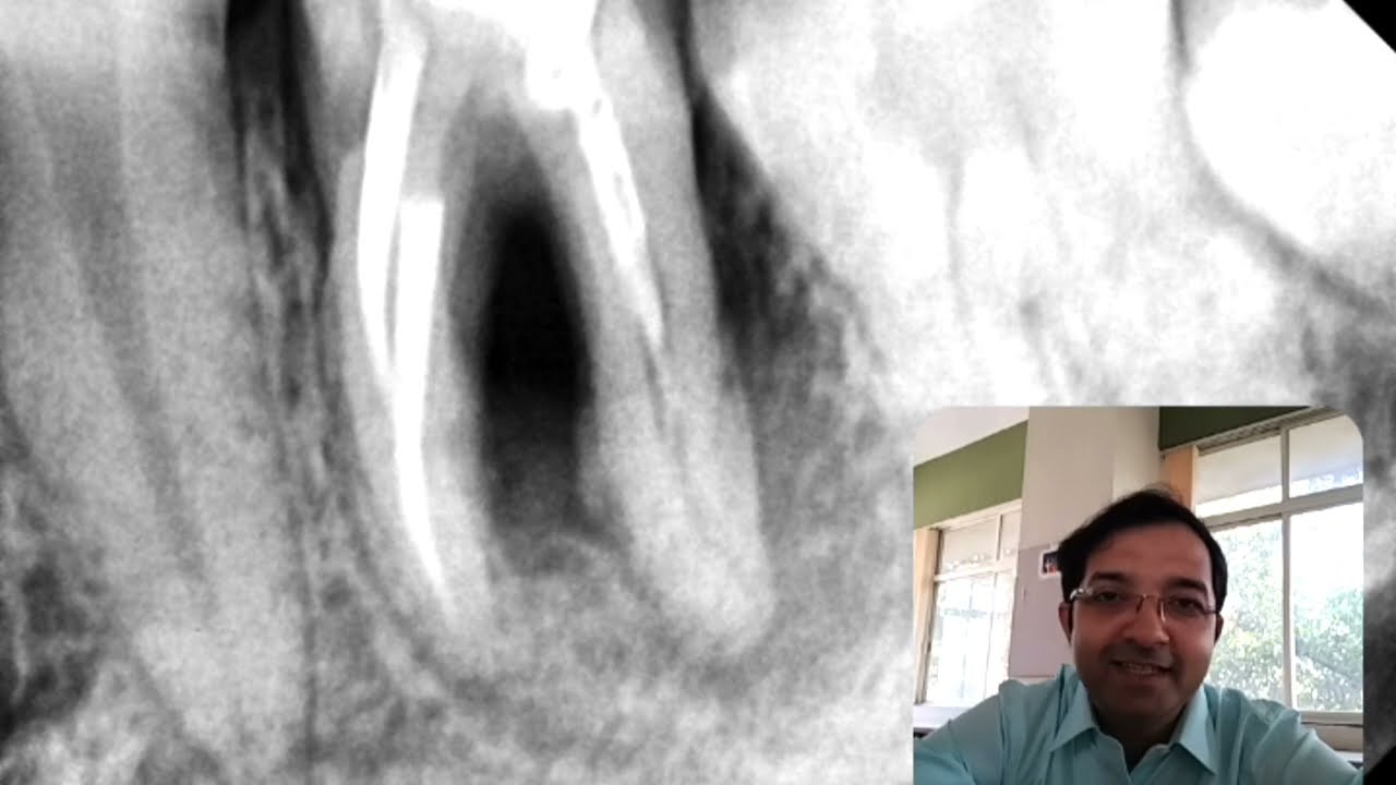 Case Discussion 12 | Dr Suresh Shenvi