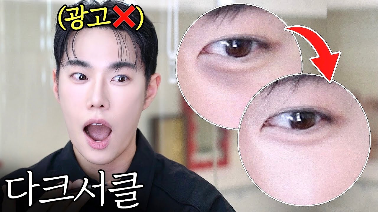 광고❌ “다크서클” 한방에 종결…! 알고보면 쉬운 