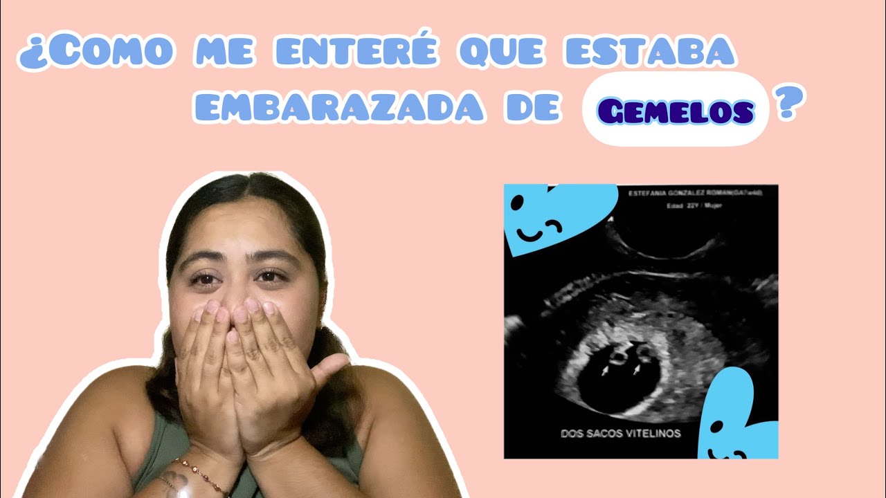 ¿Como me enteré que estaba embarazada de GEMELOS? 😱| Storytime | Fa Glez ✨