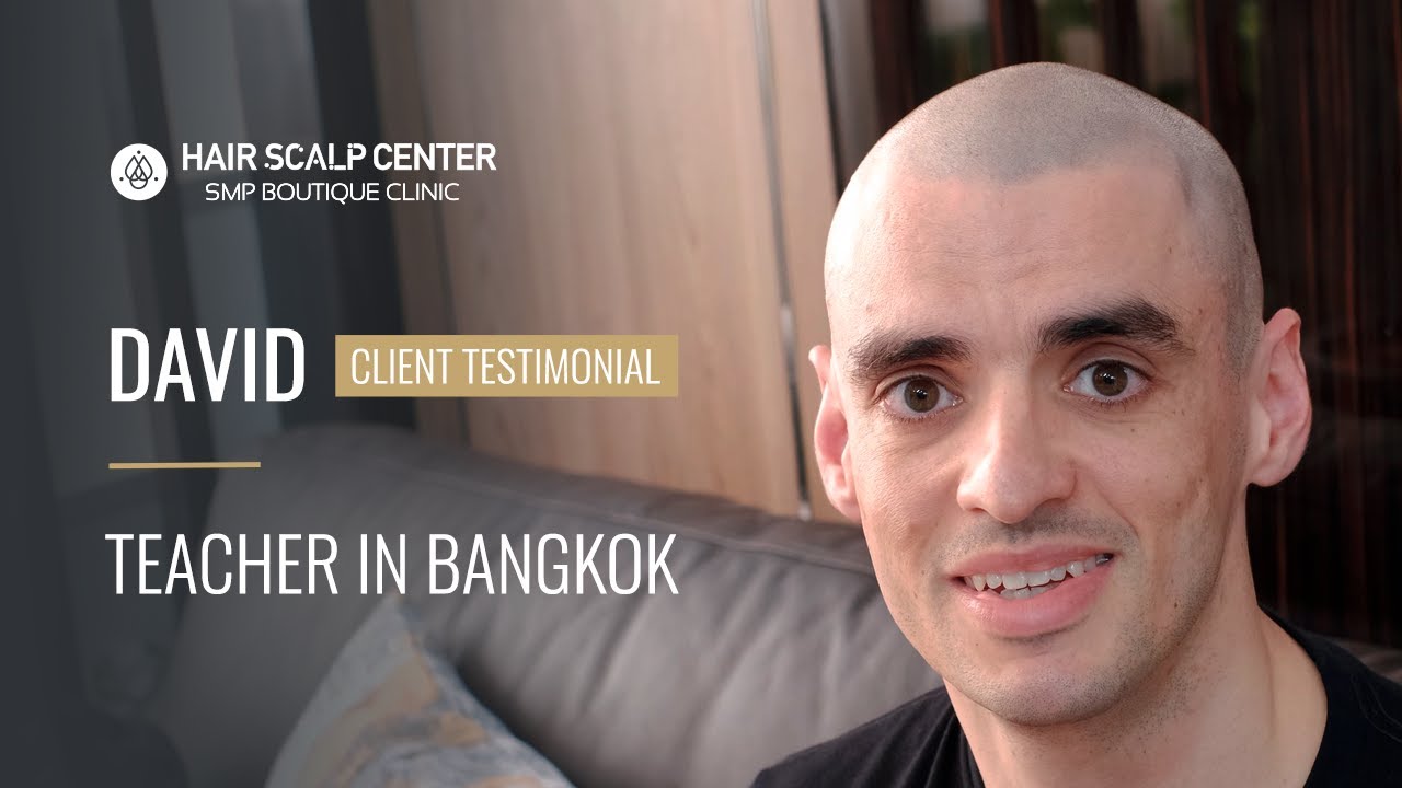 Watch David Explain Why He Decided To Have Scalp Micropigmentation Done At Hair Scalp Center