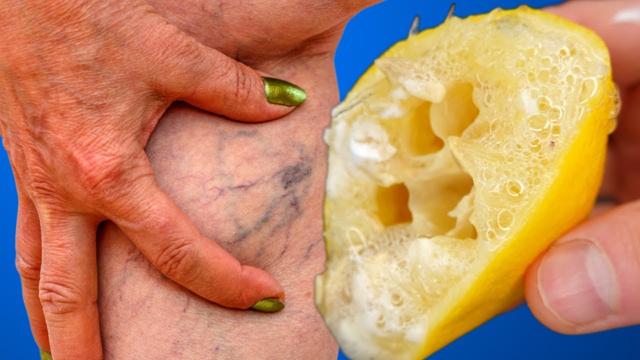 Old surgeon: on the third day, the varicose vein disappeared, take a glass every day!