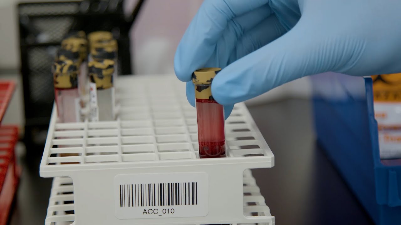 Can a cancer blood test save lives in US