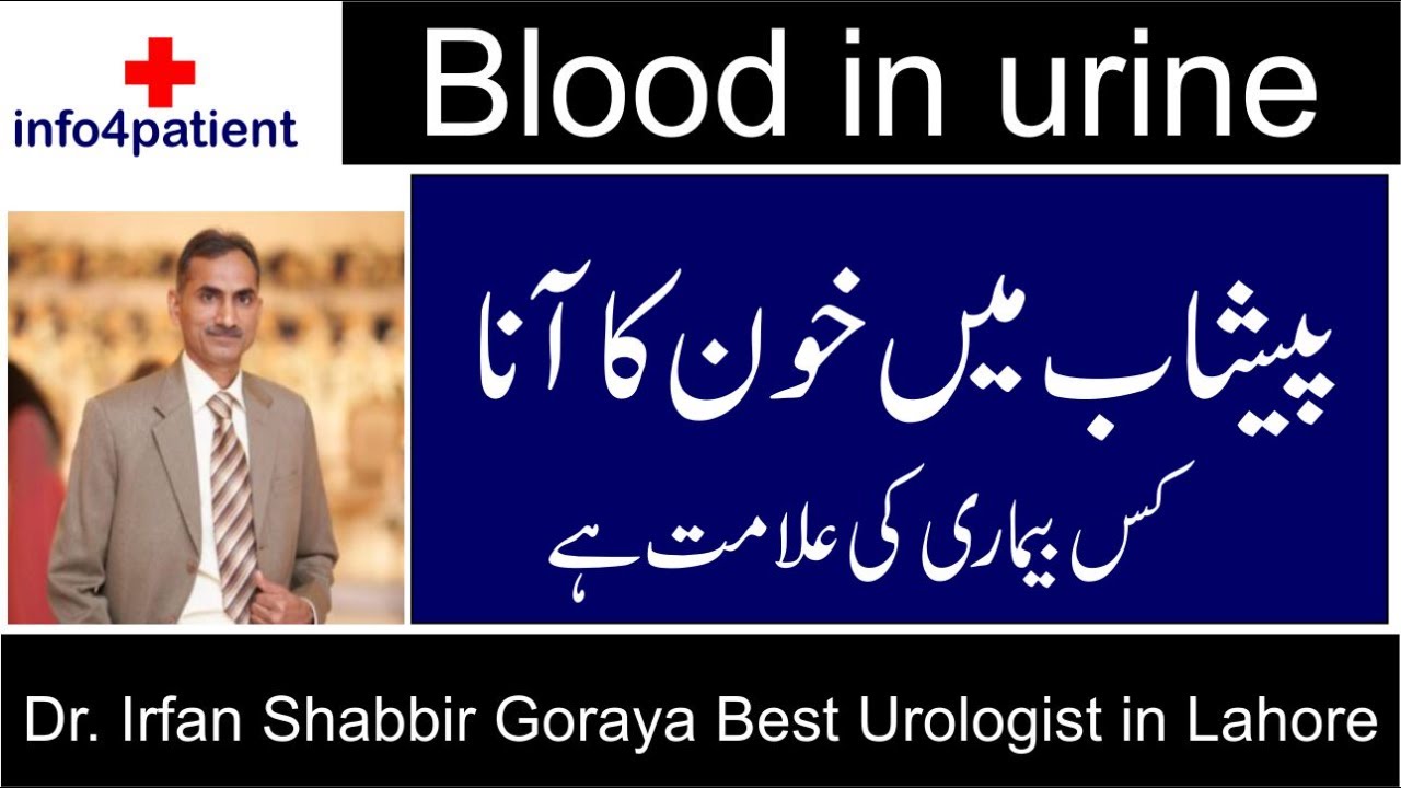 Best Urologist in Lahore - Bashab mai khoona ana - Dr. Irfan Shabbir Goraya