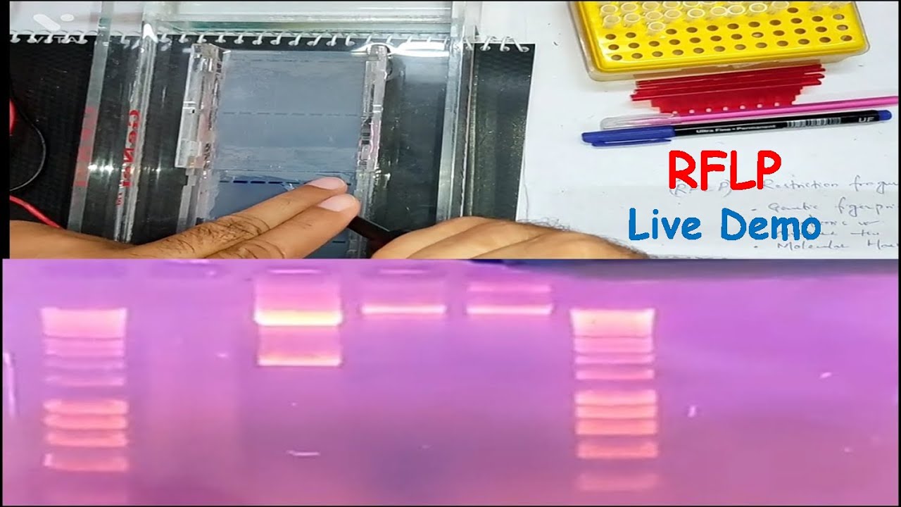 RFLP - Restriction Fragment Length Polymorphism (LIVE DEMO)