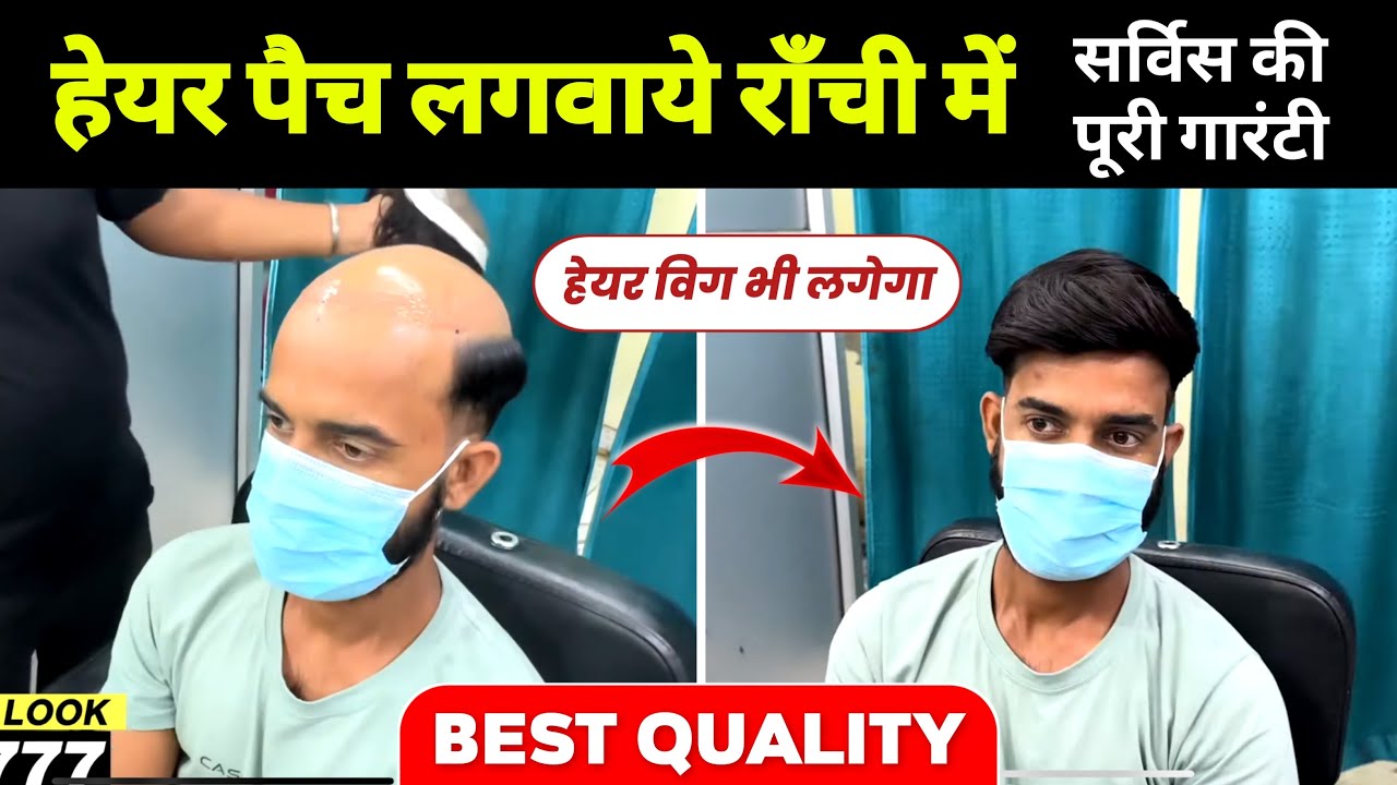 हेयर पैच राँची😍| Hair Patch Ranchi | Hair Patch For Men In Ranchi | Hair Wig Ranchi Jharkhand