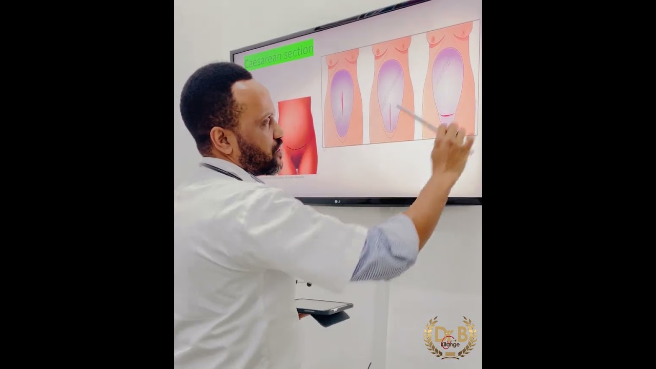 Ukifanyiwa upasuaji wa kuzaa mtoto.. mshono gani wa nje ndio wakuzingatia?