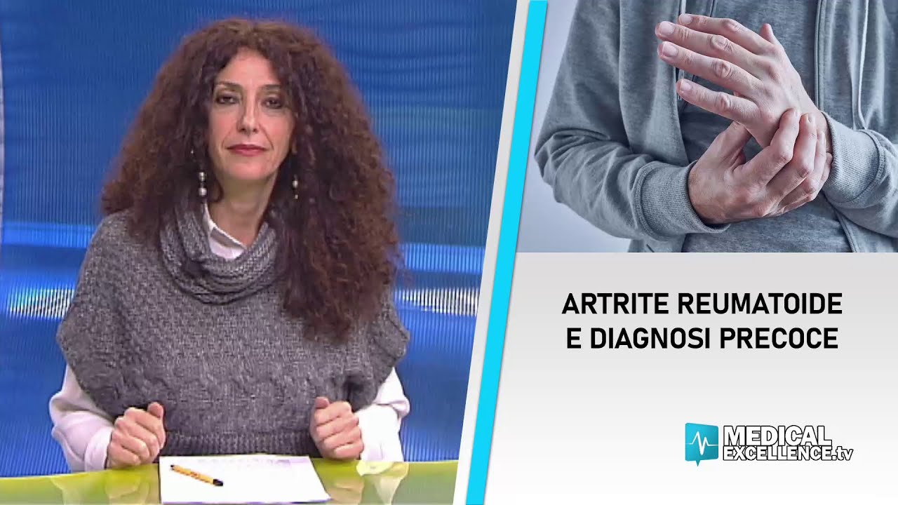 Artrite reumatoide: la strategia vincente è la diagnosi precoce