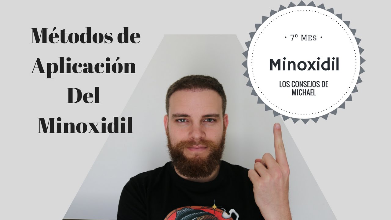 7&ordm; Mes con Minoxidil en la BARBA. M&eacute;todos de aplicaci&oacute;n.