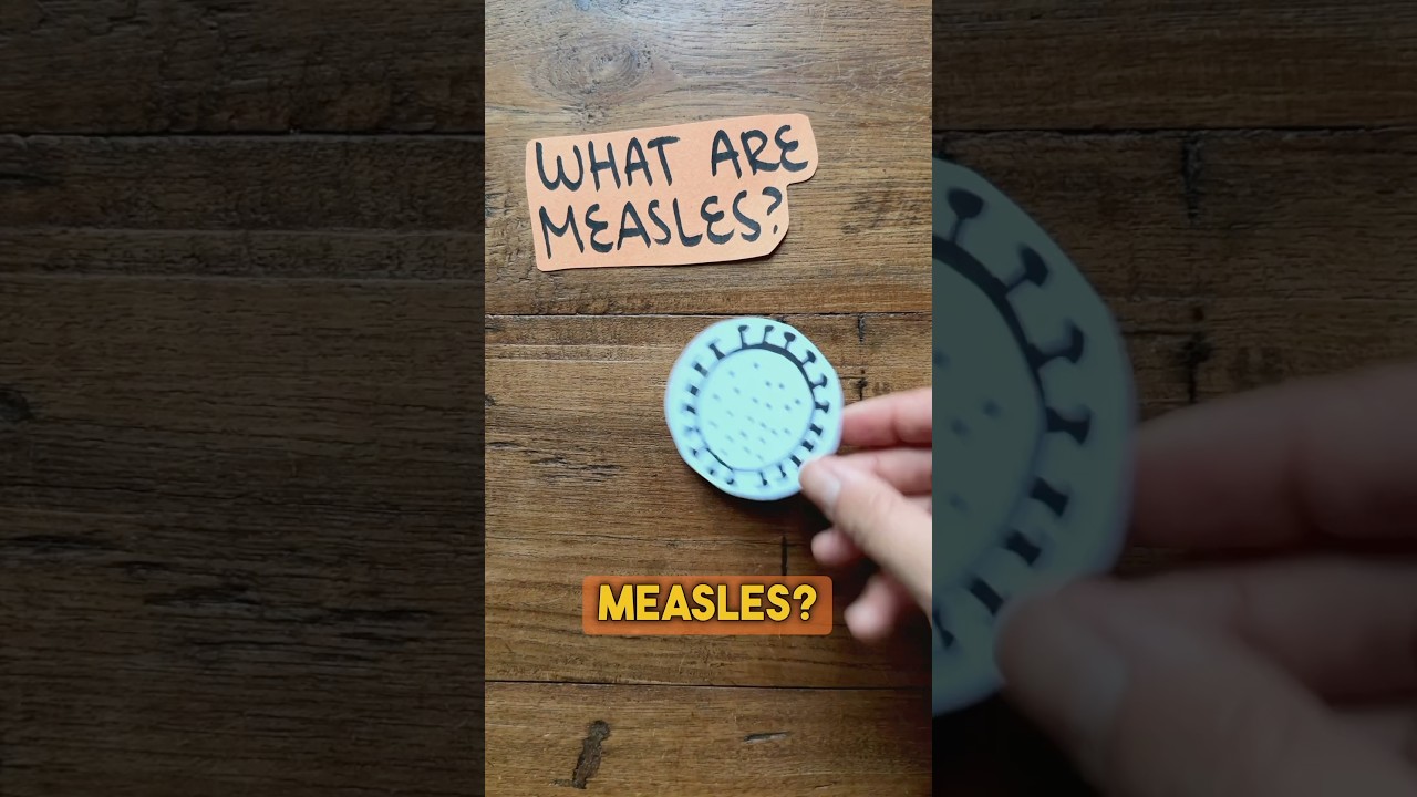 ‼️ measles outbreak 👩🏻&zwj;⚕️