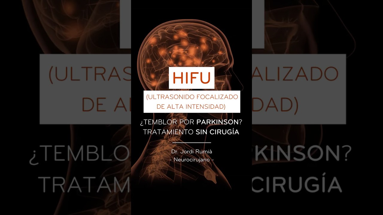 &iquest;Qu&eacute; es el HIFU y c&oacute;mo cambia la vida de personas con Parkinson? |&nbsp;Dr. Jordi Rumi&agrave; #HIFU #PARKINSON