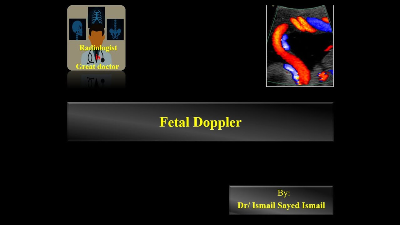 Fetal Doppler
