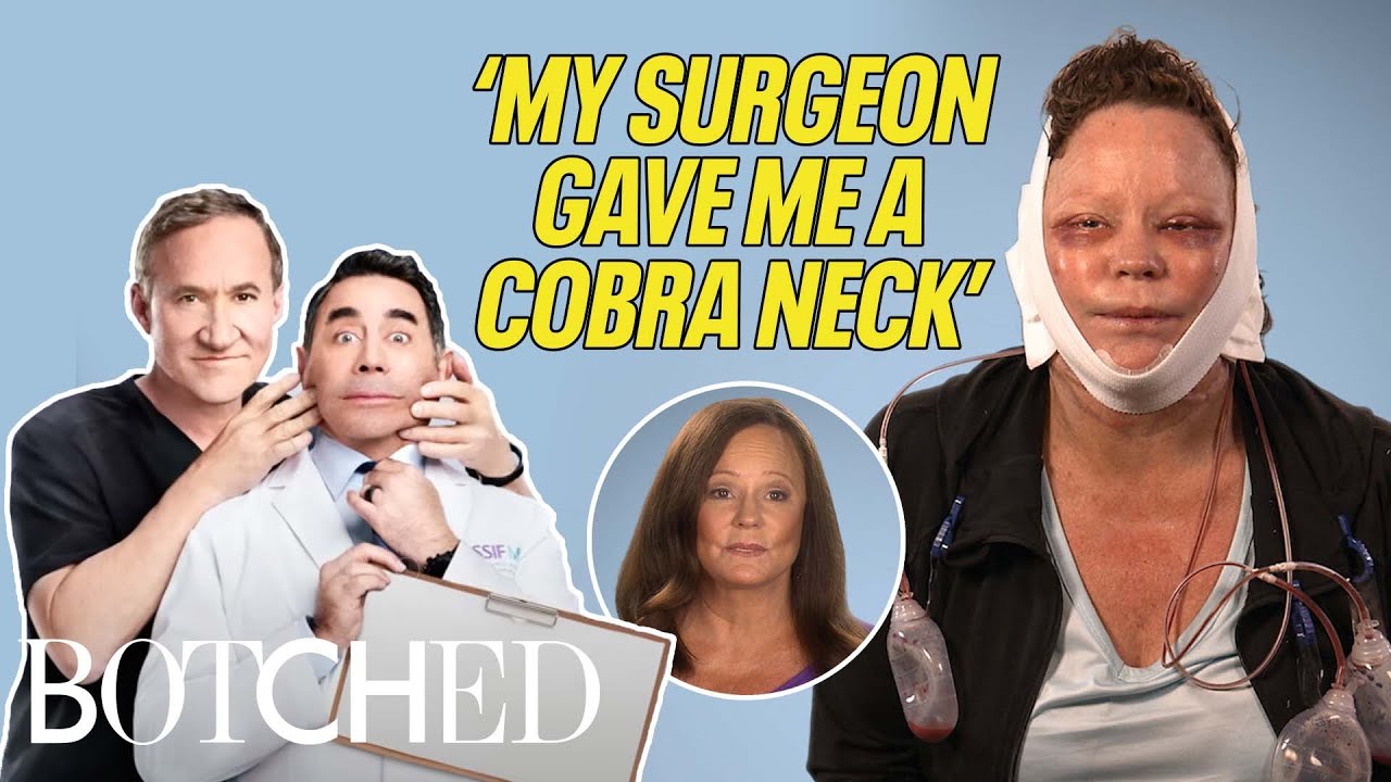 Lisa Is a Cougar With A Cobra Neck?! (Before & After) | Botched | E!