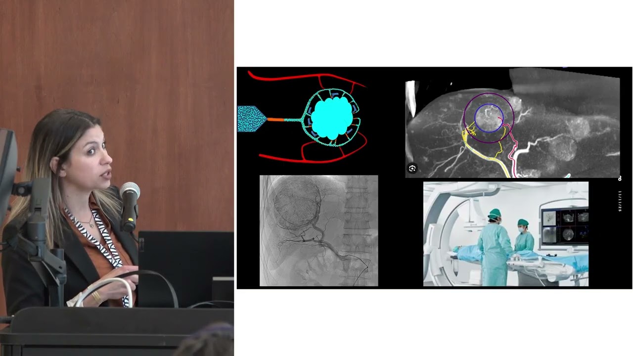3. Liver-Directed Therapy &bull; Dr. Lindsay Thornton &bull; 2025 NET Cancer Day Symposium