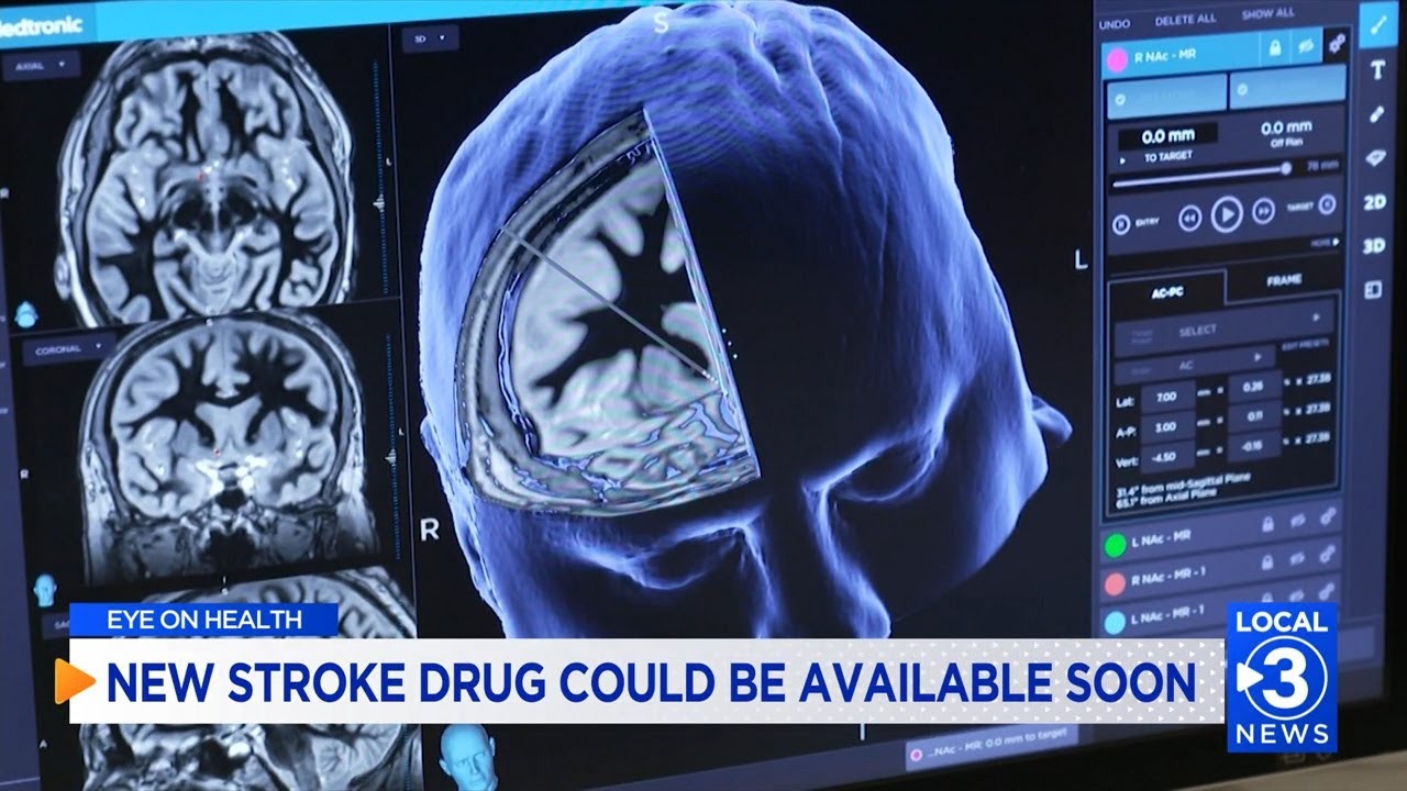 EYE ON HEALTH: Promising new stroke drug