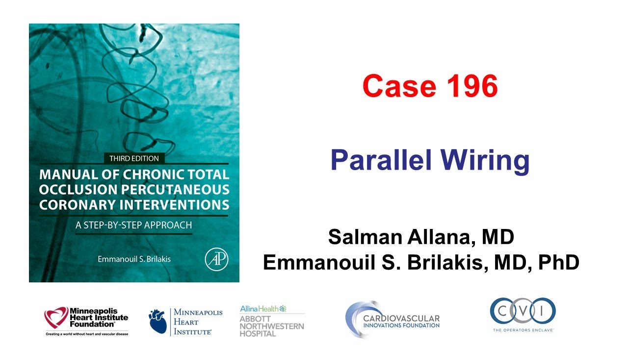 Case 196: Manual of CTO PCI - Parallel wiring