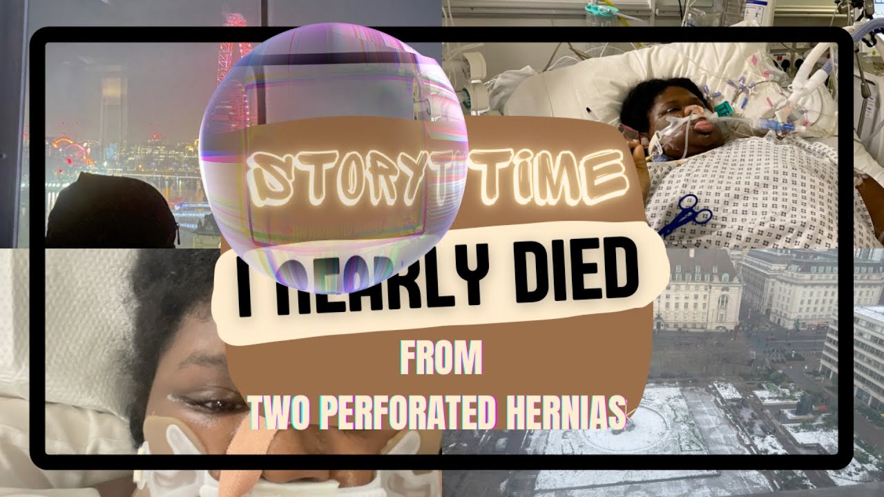 Storytime: I nearly died from two perforated hernias, went into two medically induced comas! 🍪🤎
