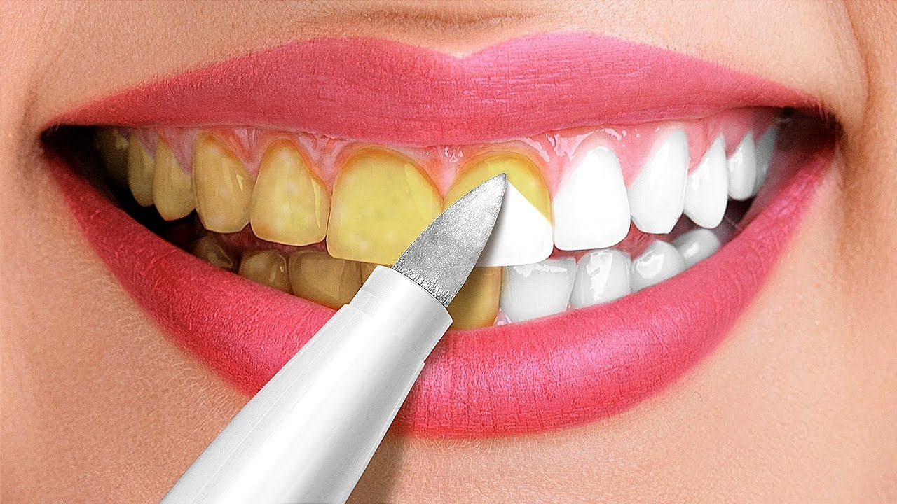 27 IMPRESSIONANTES TRUQUES PARA TER UM SORRISO BRANCO || TRUQUES E DICAS DE BELEZA