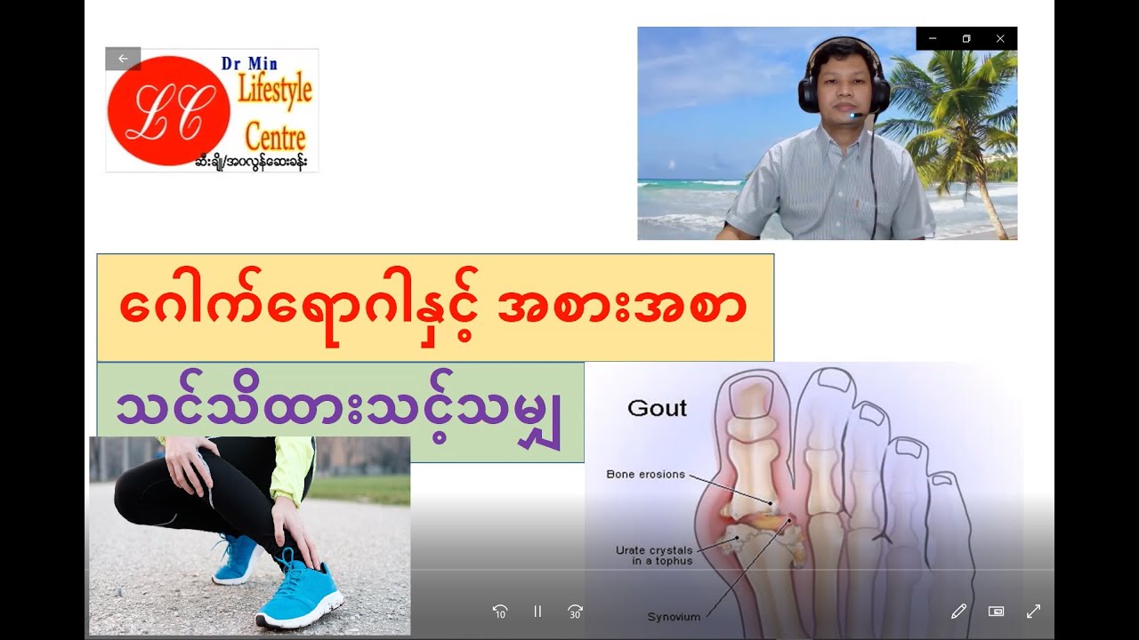 ဂေါက်ရောဂါနဲ့ အစားအစာ သင်သိထားသင့်သမျှ (Gouty arthritis)