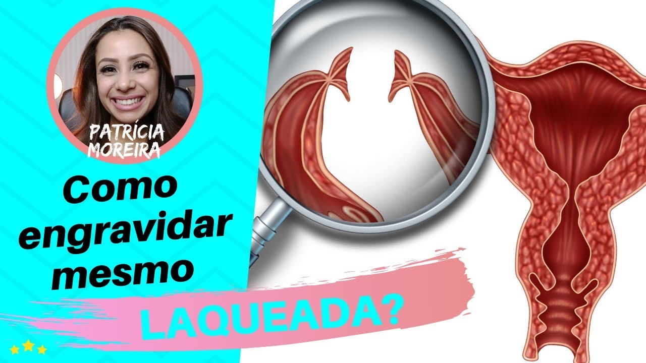LAQUEADA, quais as chances para engravidar? | Patr&iacute;cia Moreira