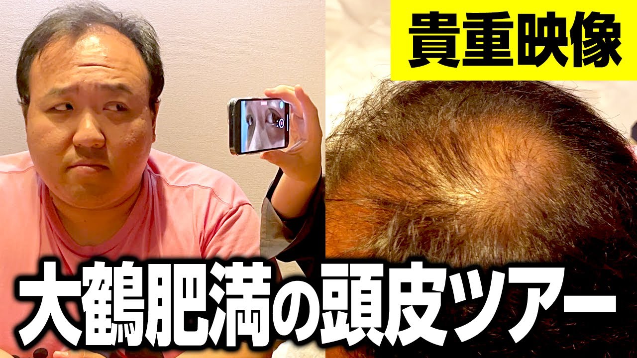 【貴重映像】大鶴肥満の頭皮ツアー #ママタルト