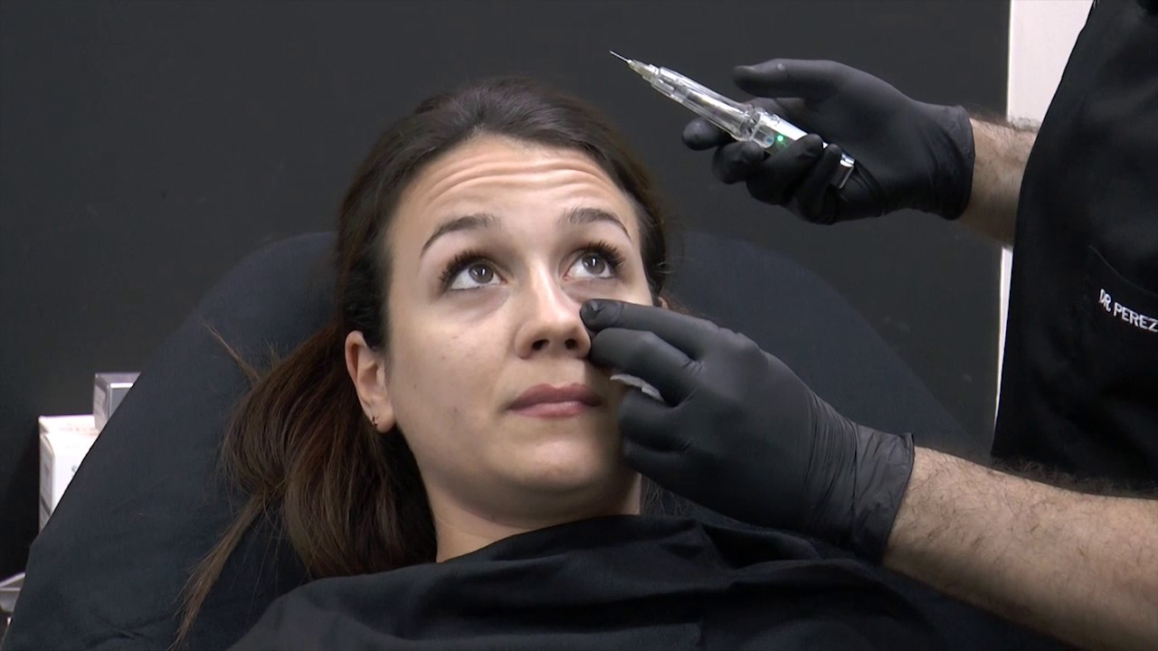 Tratamiento Ojeras