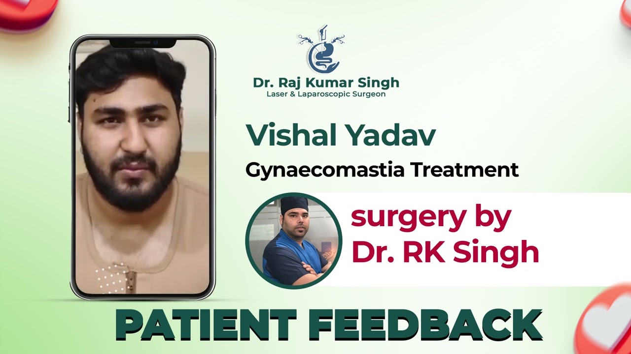Gynaecomastia treatment | best doctor for Gynaecomastia treatment | Dr. Raj Kumar Singh