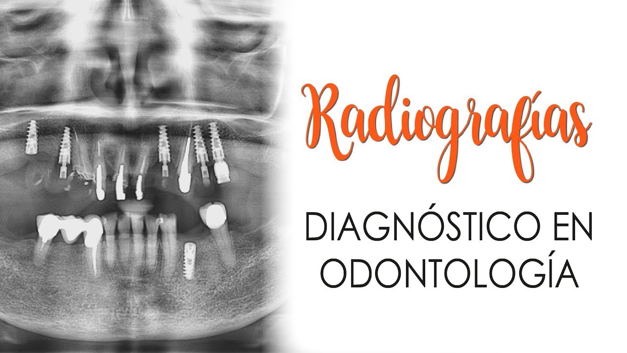 RADIOGRAFÍAS EN ORTODONCIA Y ODONTOLOGÍA | IMPRESCINDIBLES
