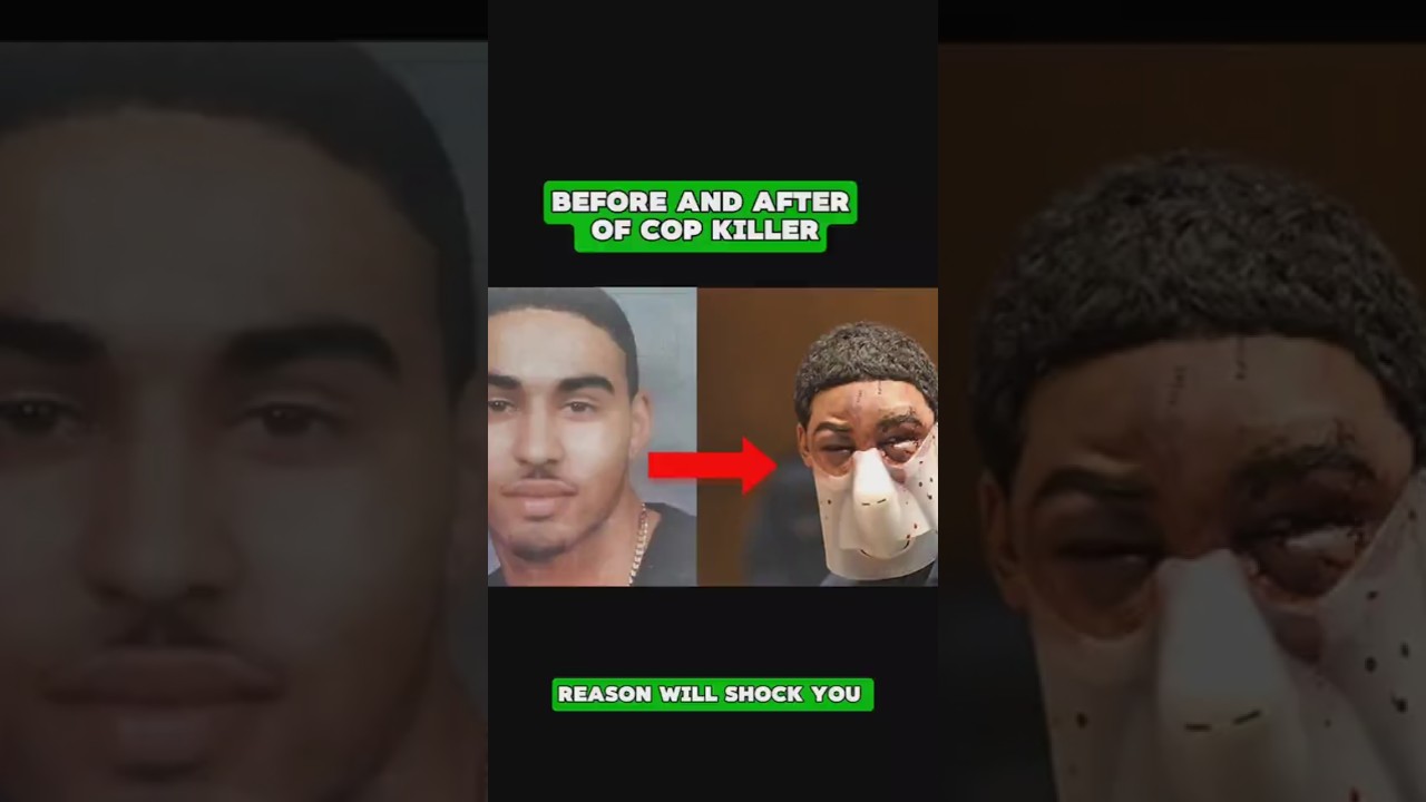 His Face Was Destroyed Before Trial Here's What Really Happened  