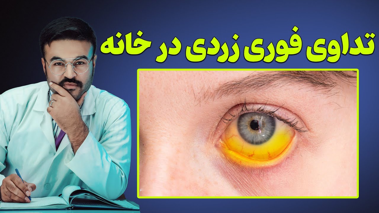 راهکارهای تداوی زردی(هپتایت)| دکتور قیس نیکزاد