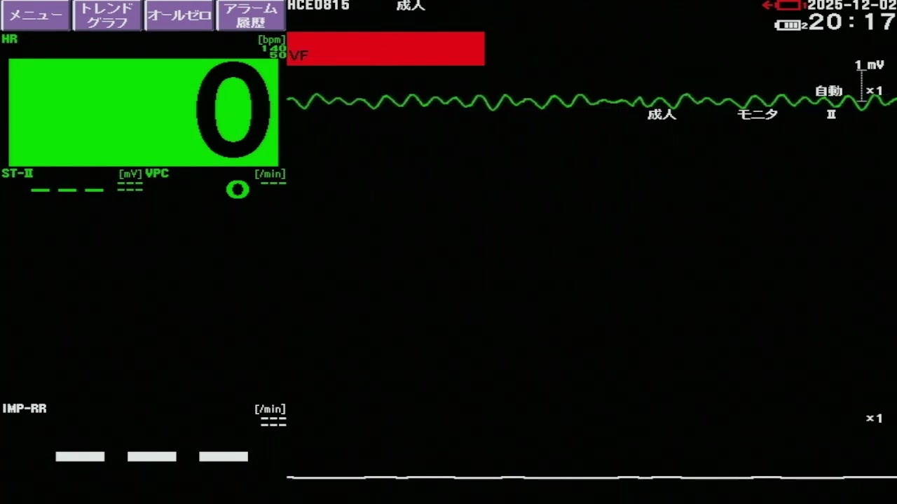 日本光電モニタ　VF アラーム音