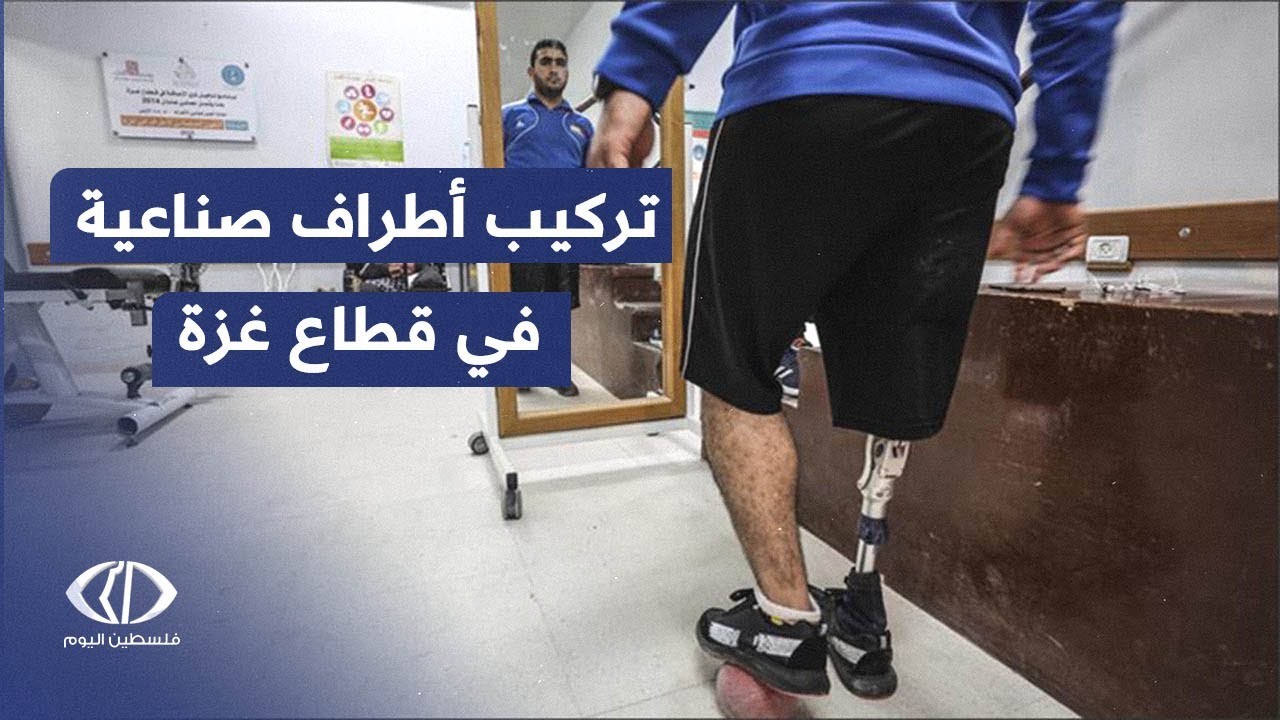 المستشفى الميداني الأردني يجري أولى عمليات تركيب الأطراف الصناعية في قطاع #غزة