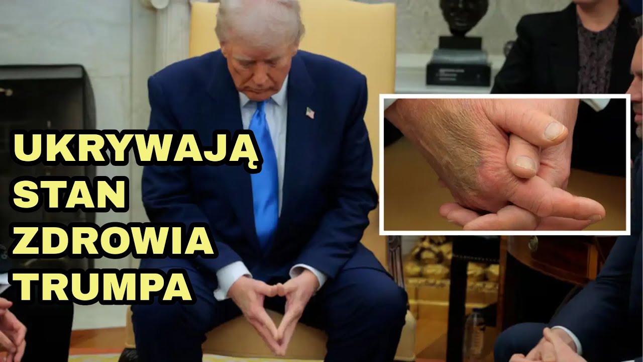 Zdrowie Donalda Trumpa - co się dzieje?!