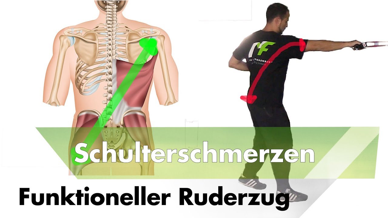 Funktioneller Ruderzug | Schulterschmerzen & -Impingement Masterplan